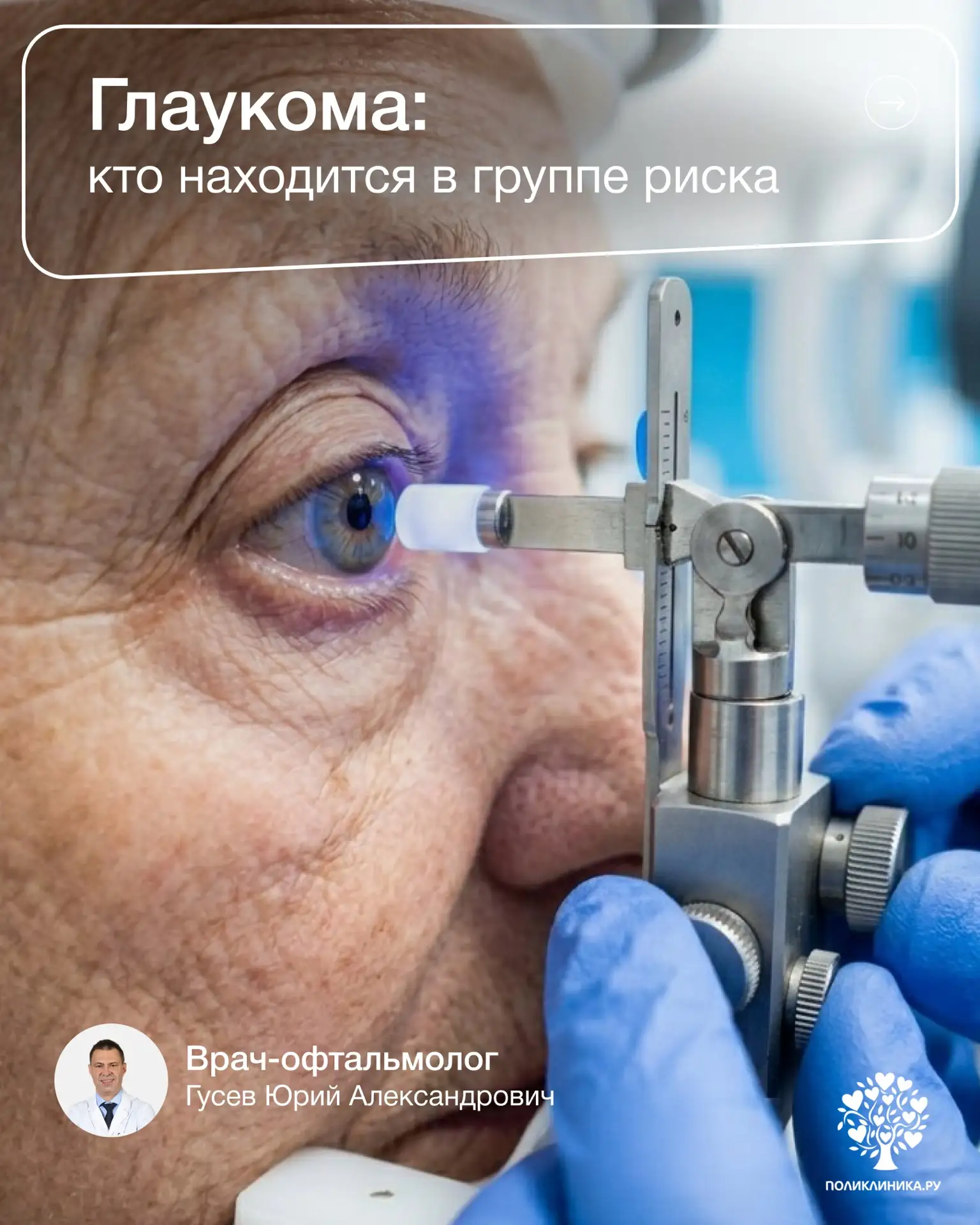 Глаукому не зря называют «тихим похитителем зрения». Заболевание может развиваться неза...