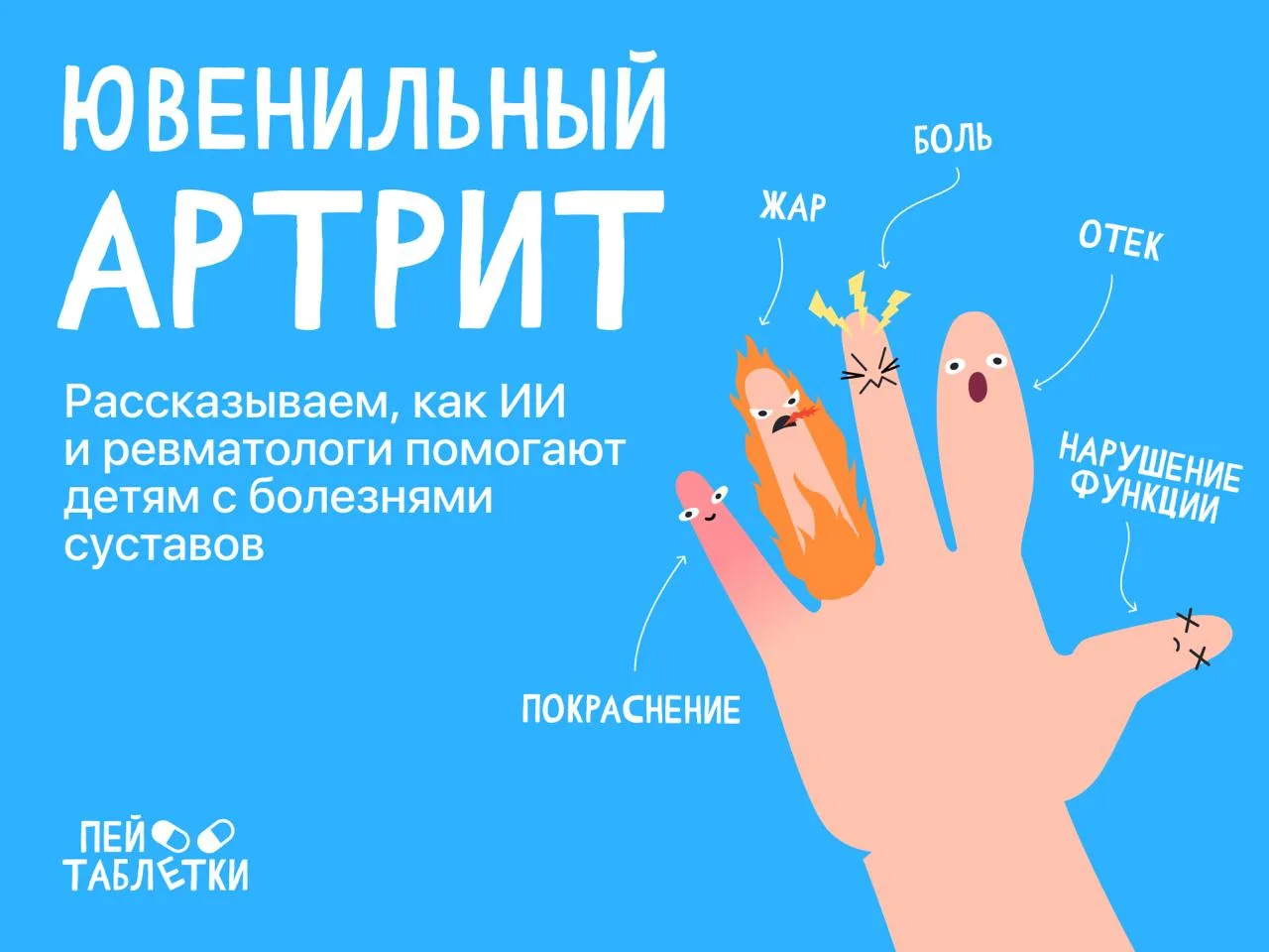 Артрит бывает даже у детей — важно его вовремя распознать 💊