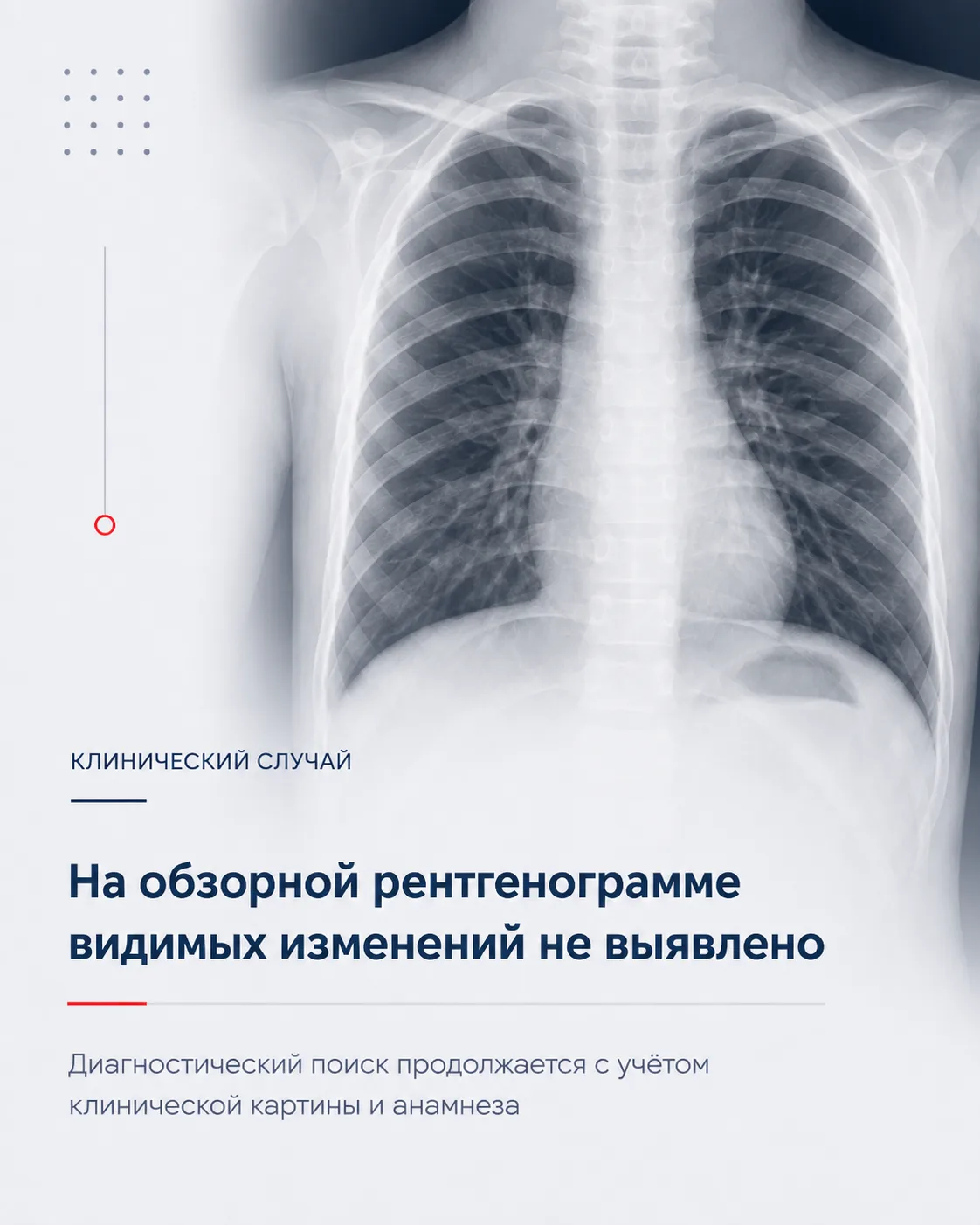 КЛИНИЧЕСКИЙ СЛУЧАЙ: когда диагностический поиск продолжается