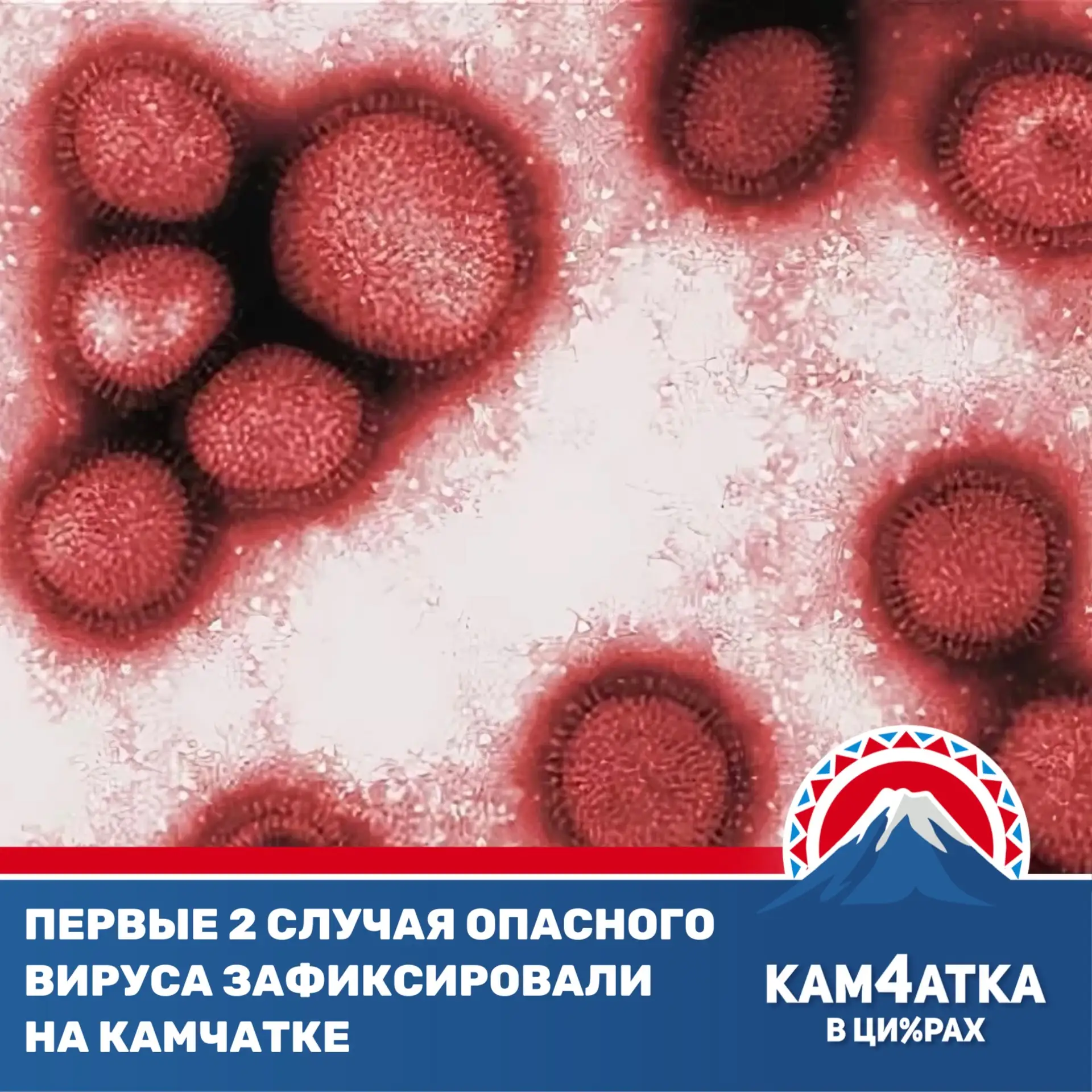 Заболеваемость ОРВИ на Камчатке выросла на 8,5% за неделю