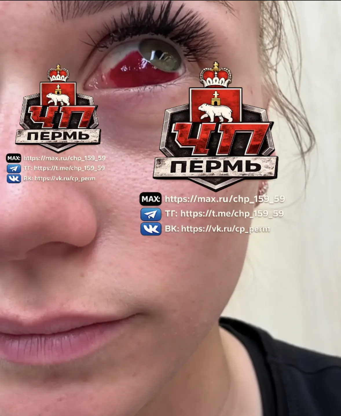 😱После наращивания ресниц, у местного мастера, жительница Кунгура едва не осталась без...