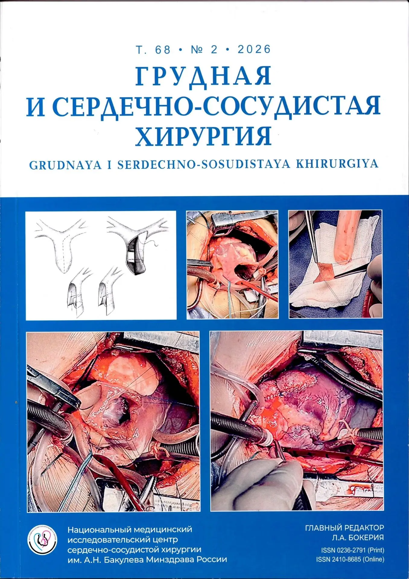 ГРУДНАЯ И СЕРДЕЧНО-СОСУДИСТАЯ ХИРУРГИЯ, 2026 № 2