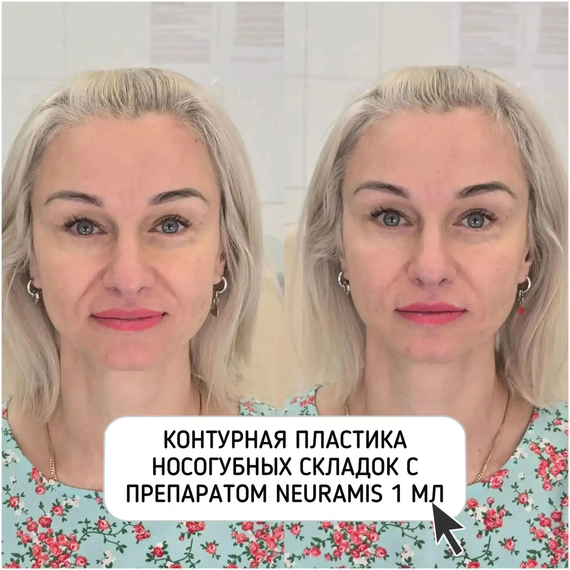 🔱АКЦИЯ НА ВСЮ ЛИНЕЙКУ NEURAMIS - 10%