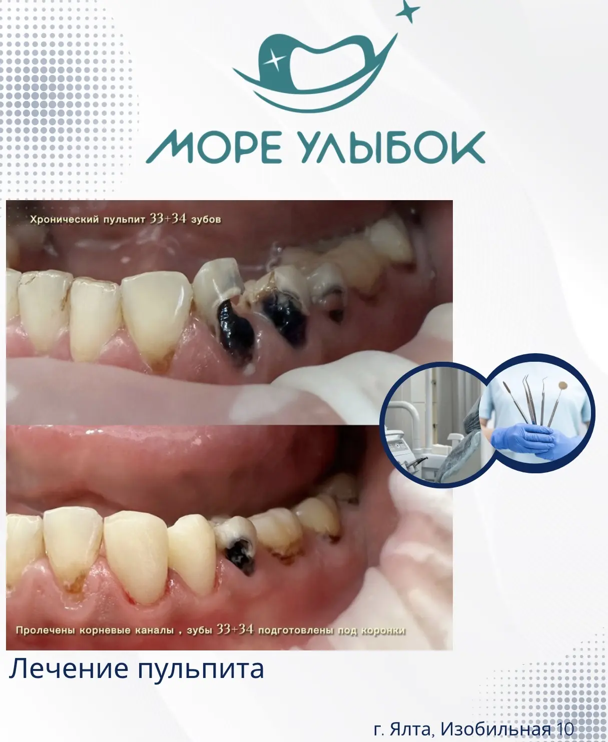 Этап преображения улыбки ✨