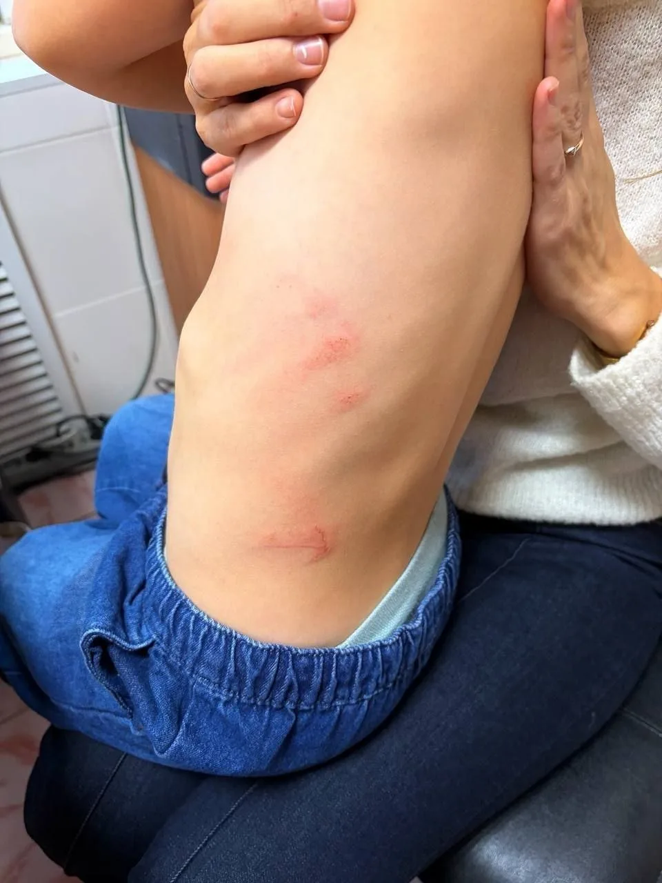Шкаф рухнул на малышей в детсаду Томска