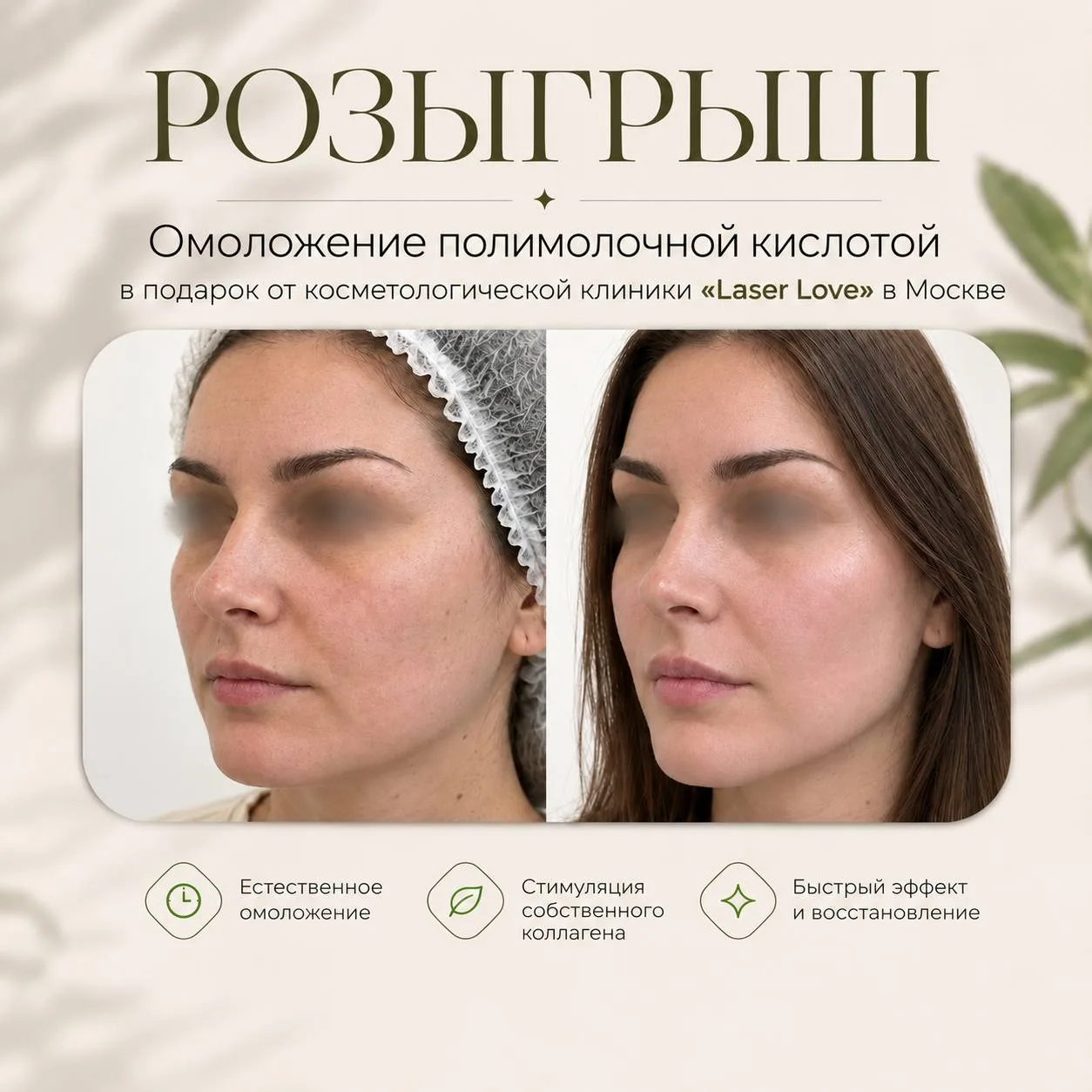 Москва, честный розыгрыш омоложения полимолочной кислотой! 💋