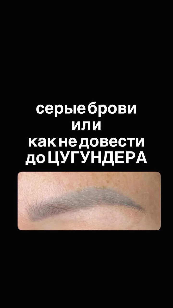 ☝️Девочки, продолжаю тему удаления желтого. Вчера на эфире Мастер-класса были вопросы.