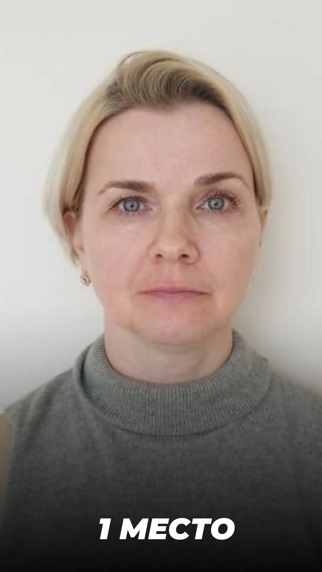 #барсегян #акцияфорум #омоложениелица