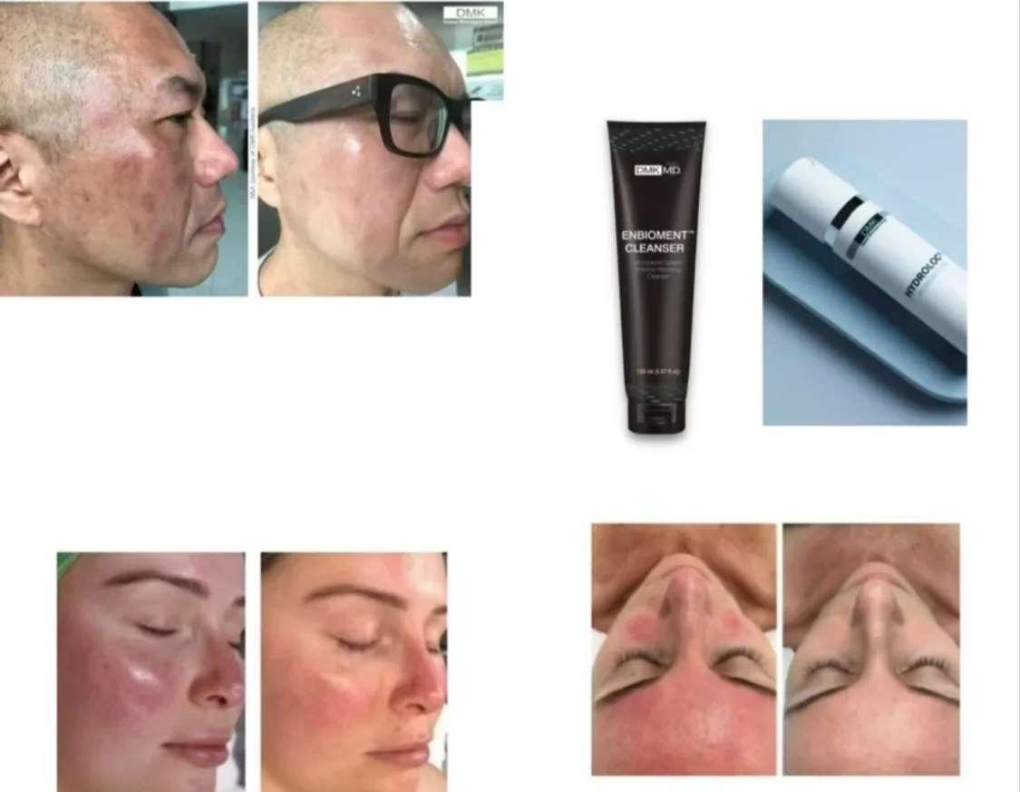Когда skincare routine,