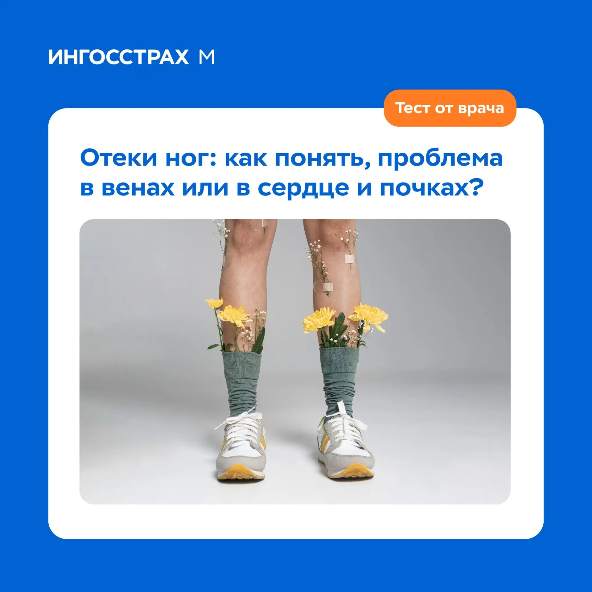 Отеки ног: как понять, проблема в венах или в сердце и почках? Быстрый тест от врача