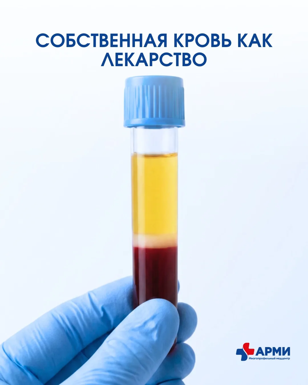 Собственная кровь как лекарство: как это работает? 🩸

Звучит необычно, но именно на этом принципе о