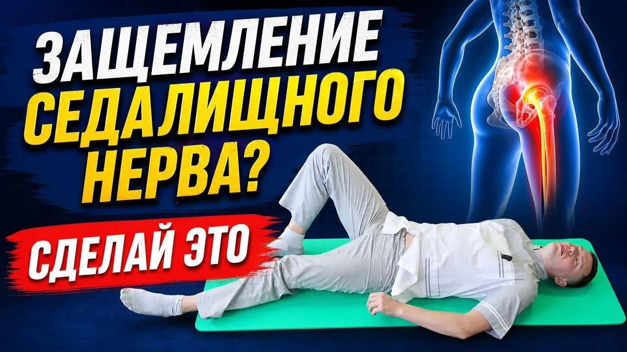 Одно упражнение при защемление седалищного нерва! Устраняем боль за 2 минуты (не в острый период).

