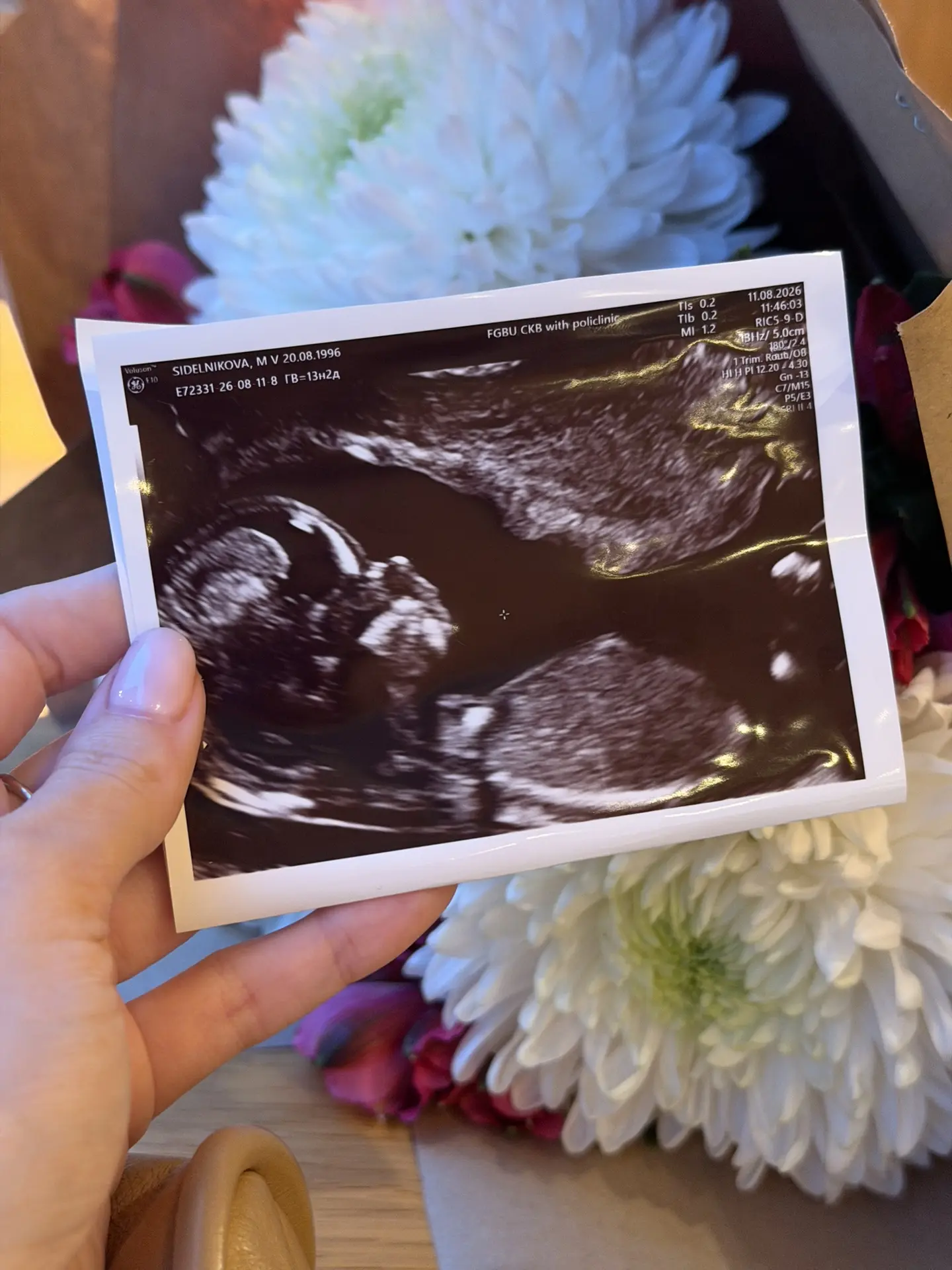 Встречаю свое 30-ти летие вот с таким подарочком 🤰💔 Кто бы думал, что на мой юбилей п...