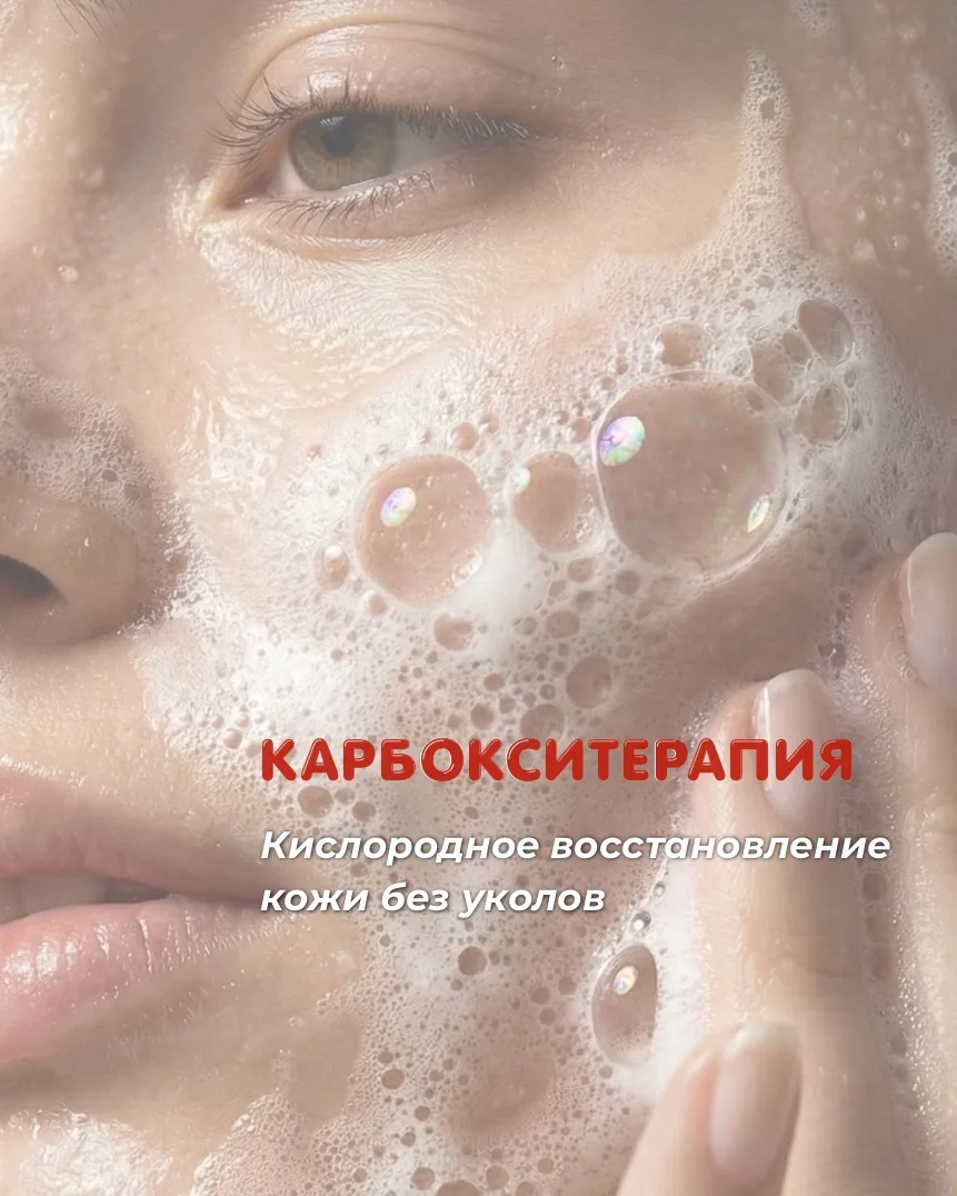 ПОЧЕМУ ВСЕ ГОВОРЯТ ПРО КАРБОКСИТЕРАПИЮ? 🫧