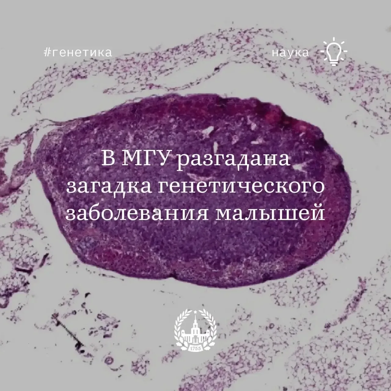 Найден генетический ключ к редкому заболеванию