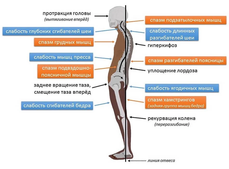 👣 ПОЧЕМУ СТОПА ЗАВАЛИВАЕТСЯ ВНУТРЬ ИЛИ НАРУЖУ?   Скажем сразу, не надо думать, что все проблемы от с