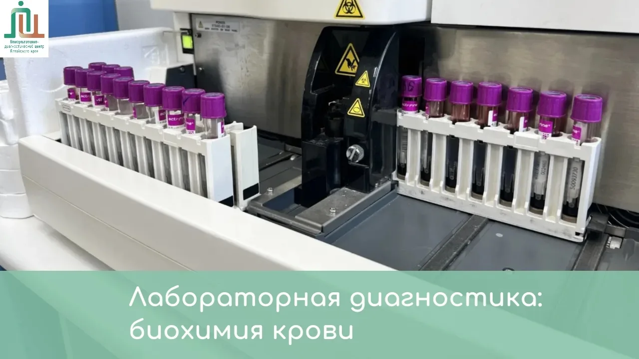 #диагностика
Лабораторная диагностика в КДЦАК: биохимия крови

🌡Биохимический анализ крови — первое