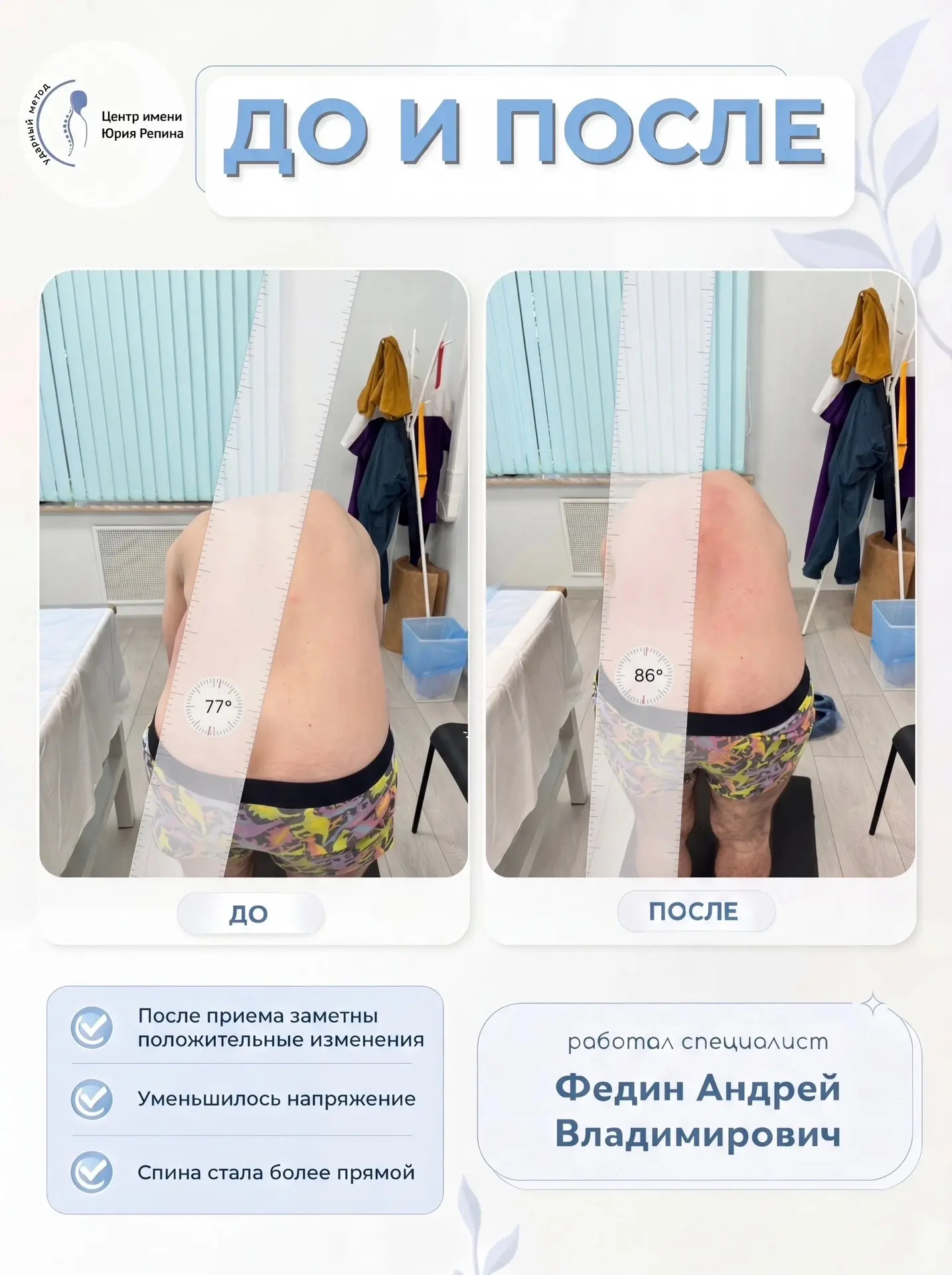 ДО И ПОСЛЕ. Работа Федина Андрея Владимировича.

Со временем тело может терять привычную подвижность