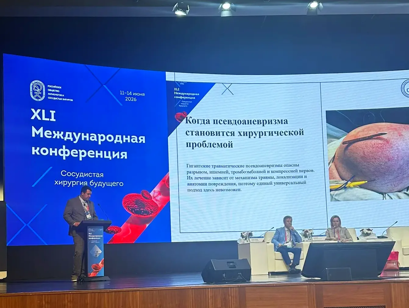 Федор Сергеевич Попивненко представил доклад на тему «Особенности лечения гигантских ложных аневризм