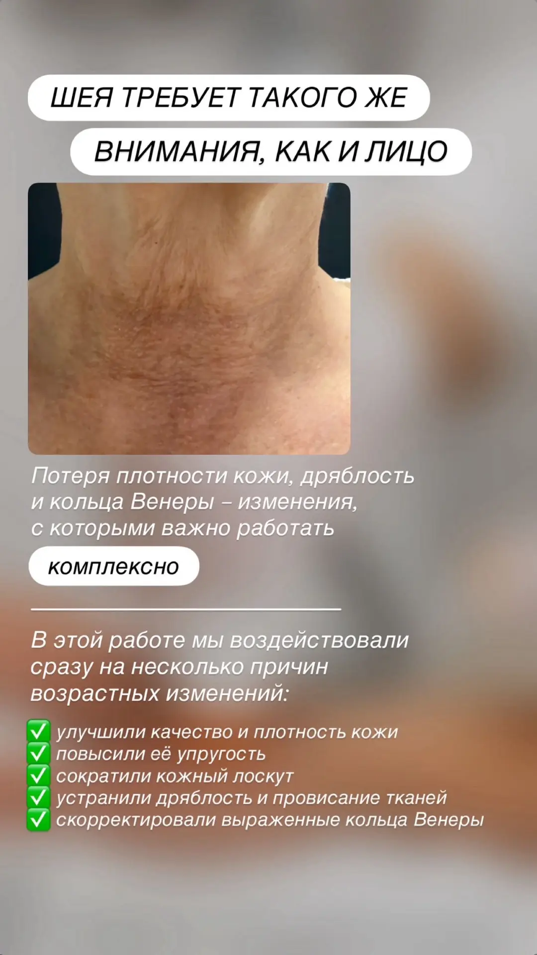 ВЕРНУЛИ МОЛОДОСТЬ ШЕЕ КОМПЛЕКСОМ ПРОЦЕДУР 👏