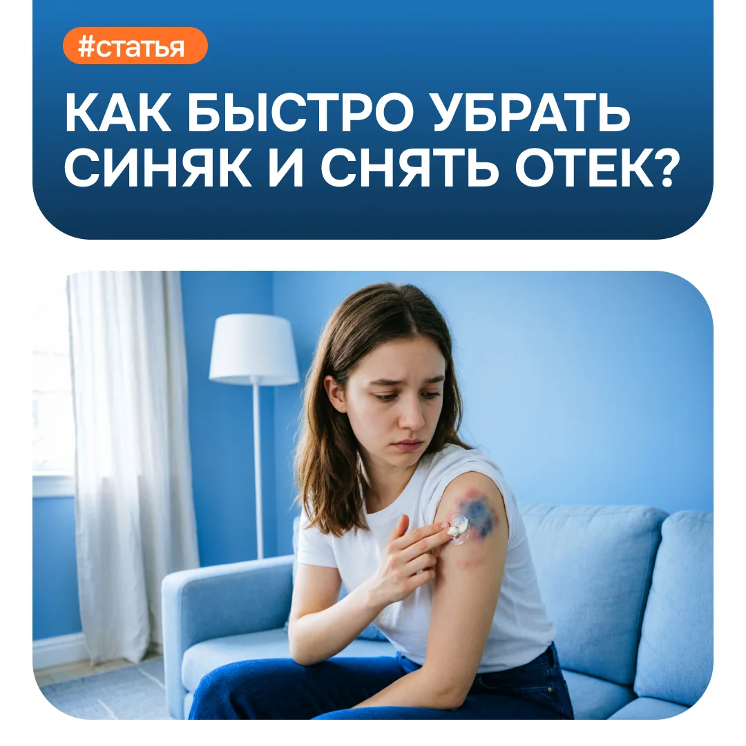 Синяк — это не просто пятно на коже, а скопление крови в тканях из-за повреждения сосуд...