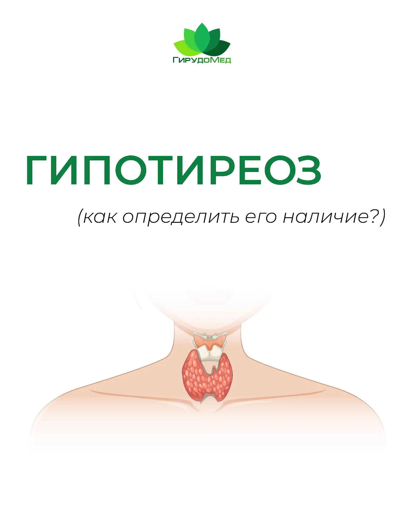 Гипотиреоз: как понять, что проблема может быть в щитовидной железе?