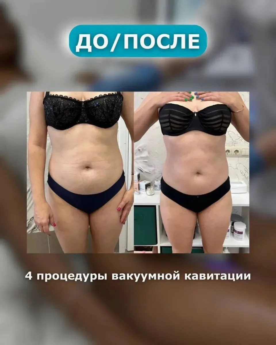 BOSS в сфере коррекции фигуры💗