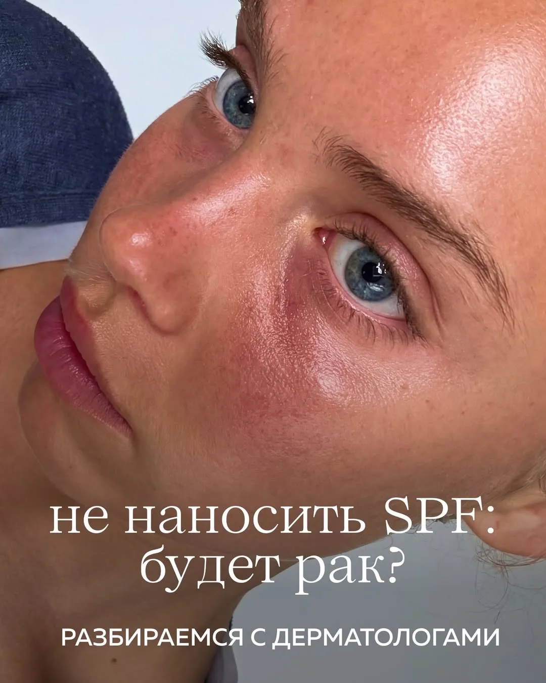 Солнце — это не всегда друг