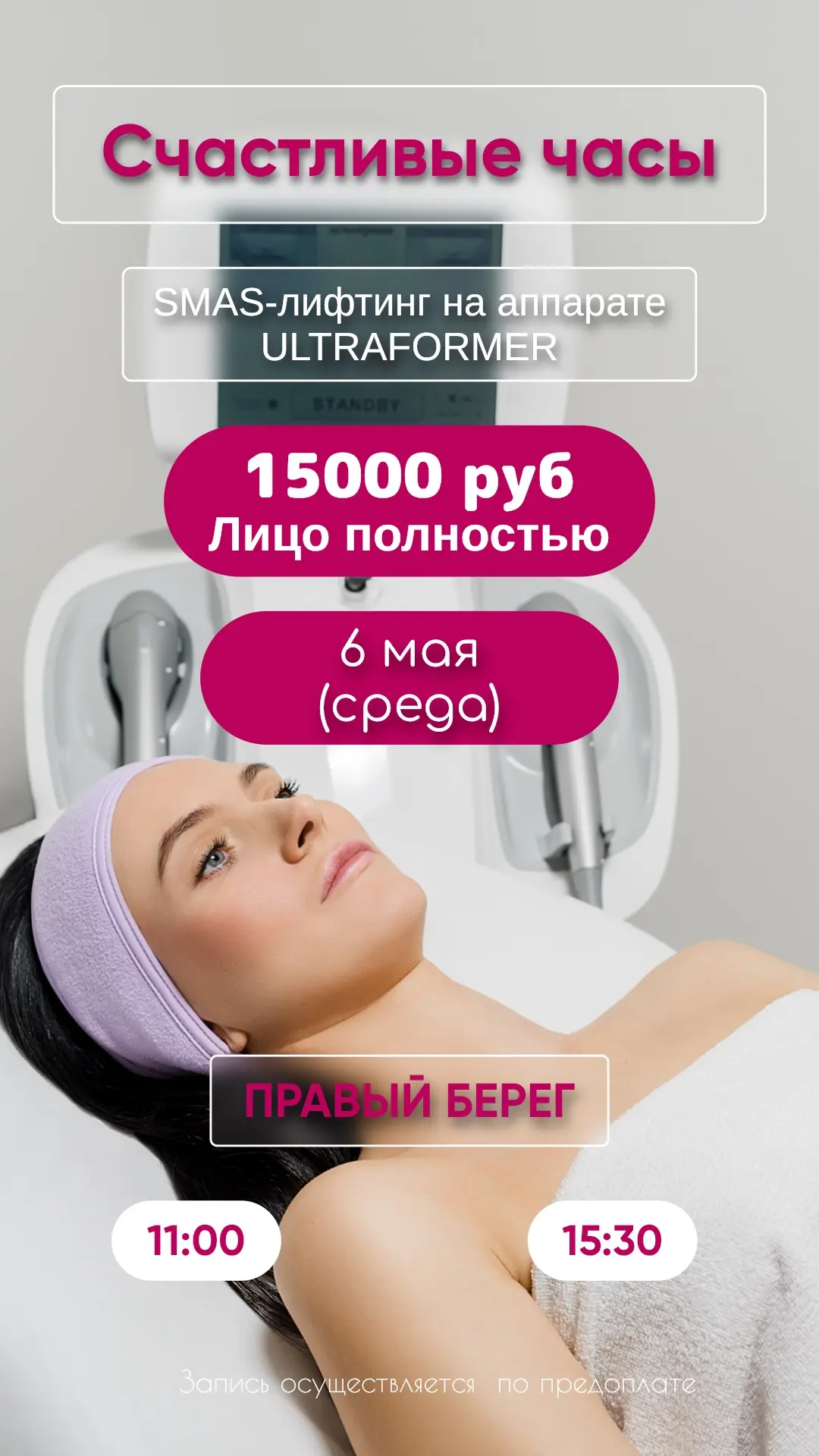 Счастливые часы на SMAS лифтинг!