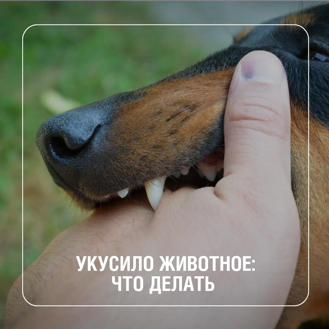 Укус животного — это ситуация, которая может произойти с каждым. Опасность представляют...