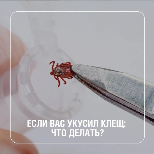 Если обнаружили клеща после прогулки в парке или на природе?