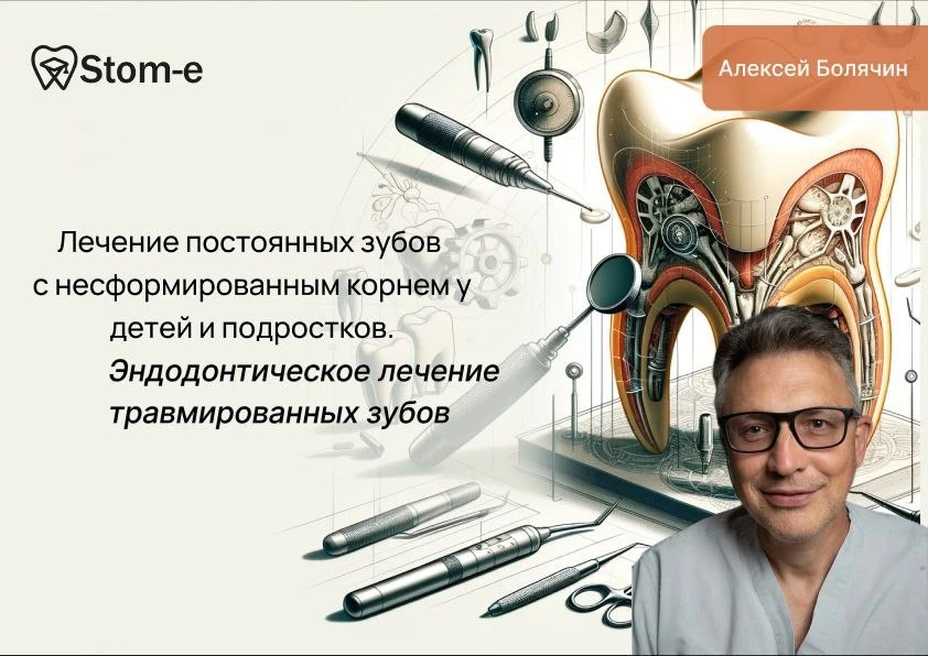 Лечение постоянных зубов с несформированным корнем ❌