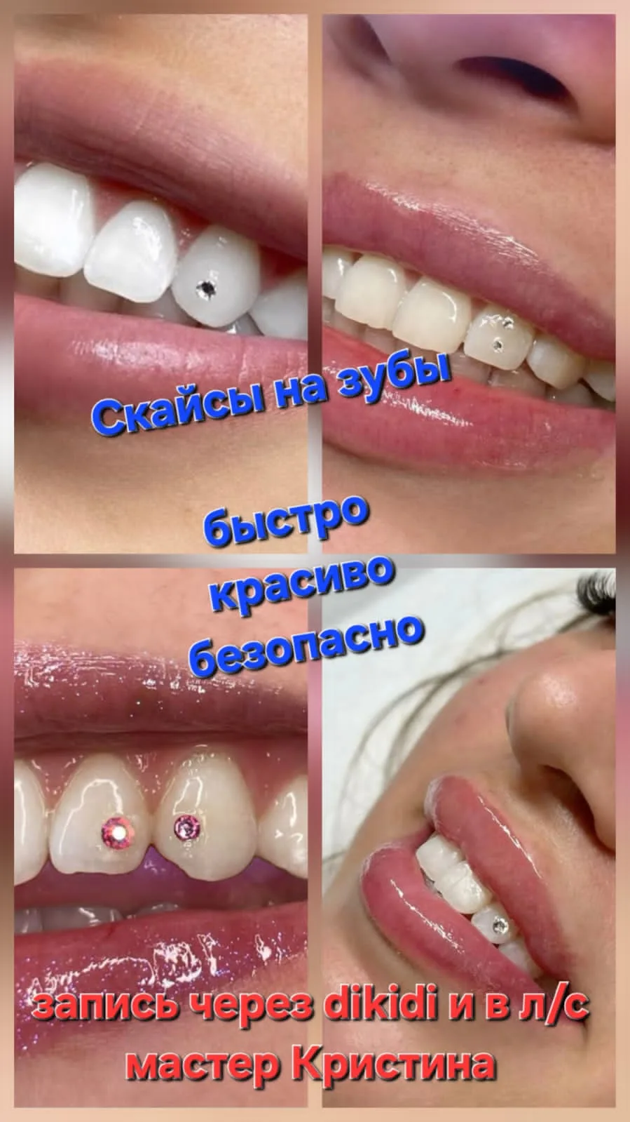 Фото