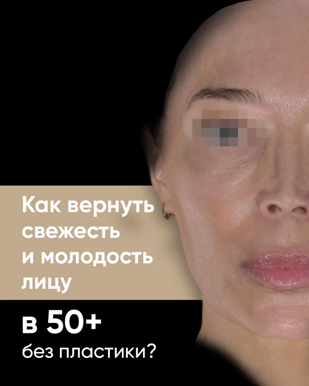 Кейс пациентки 57 лет — пример того, как комплексный подход позволяет мягко и естествен...