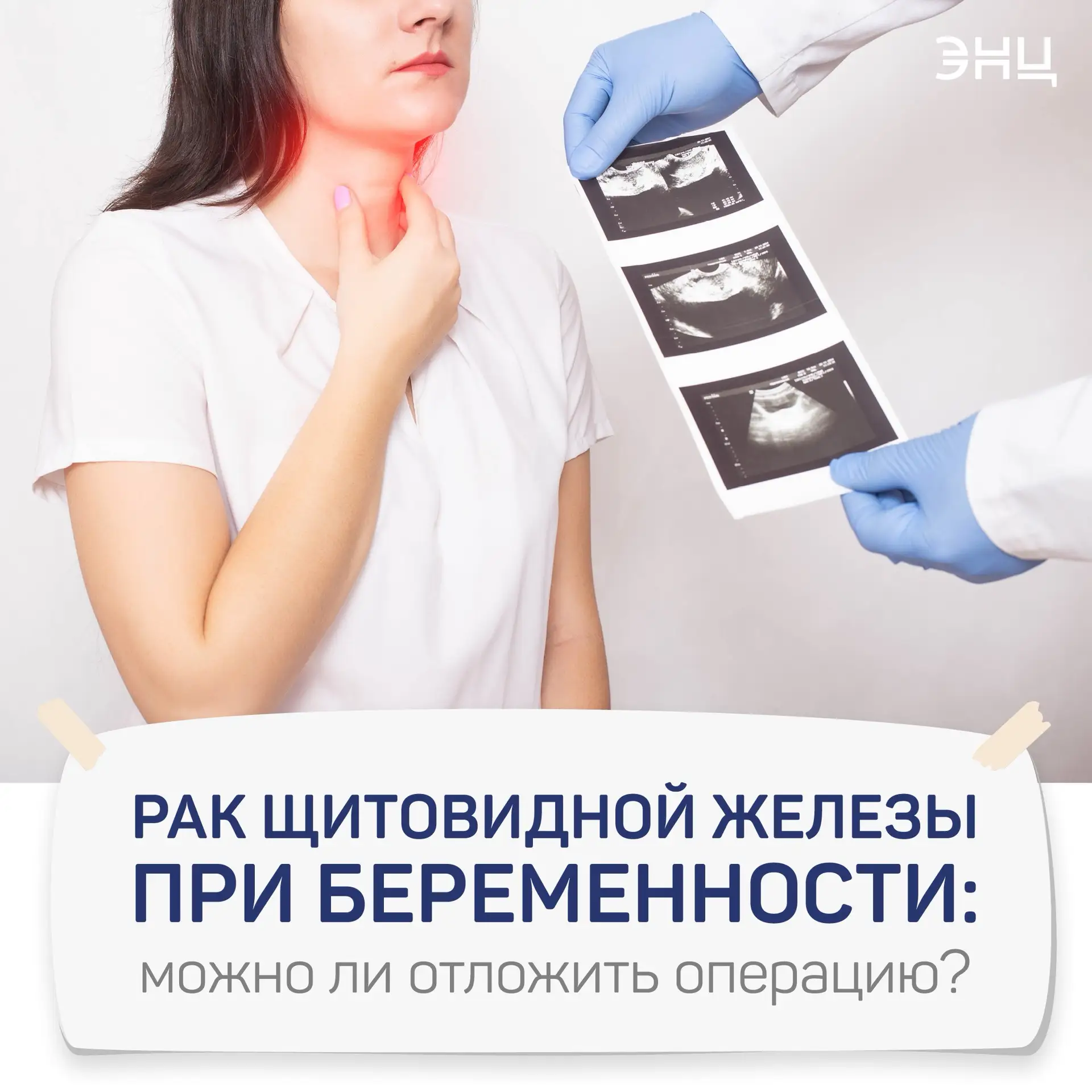 🤰Рак щитовидной железы при беременности: можно ли отложить операцию?
 
Если у вас обнаружили рак щи