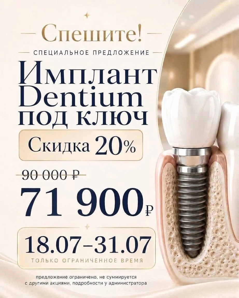 🔥 Импланты Dentium под ключ со скидкой 20% — успевайте!