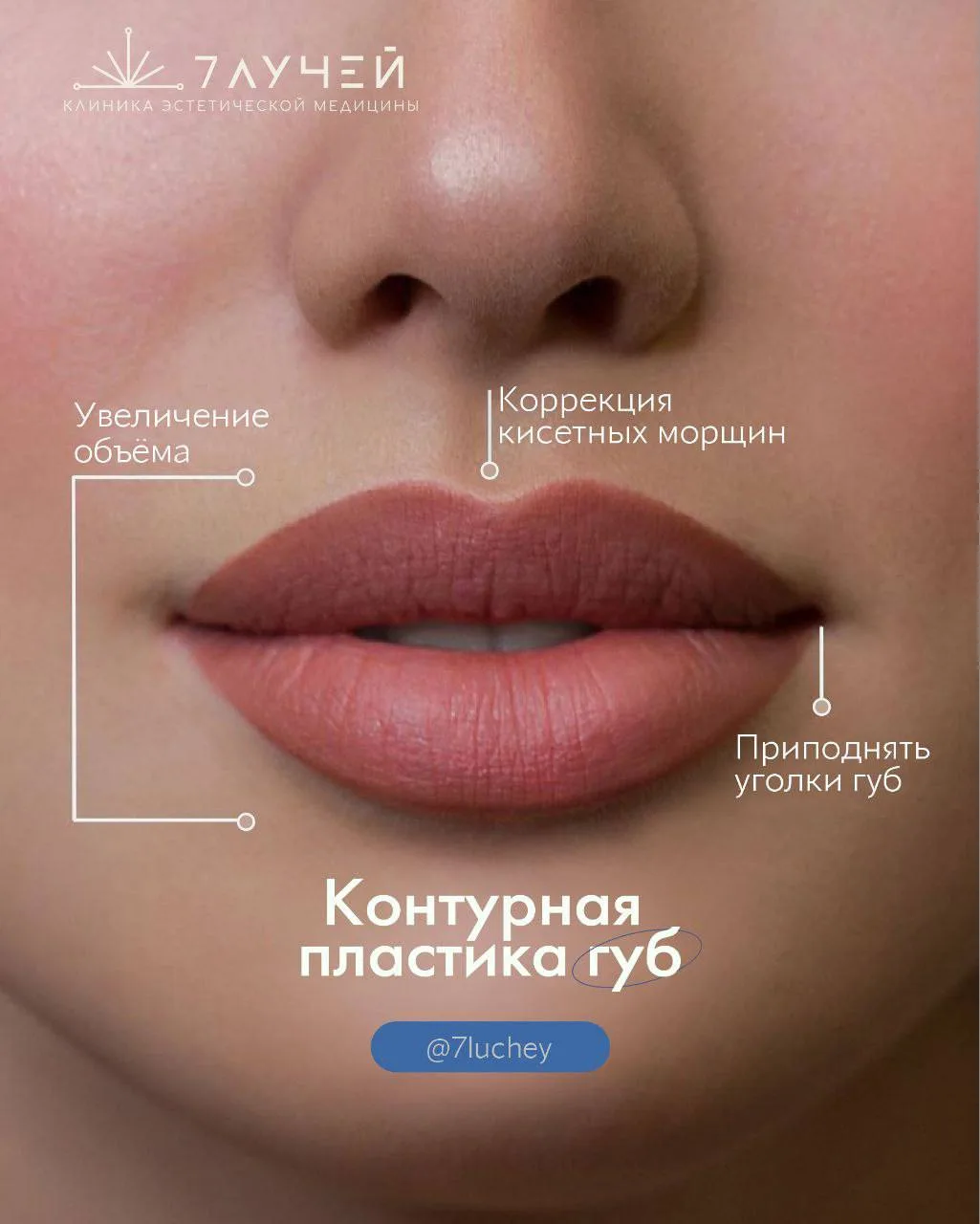 Красивые, гармоничные губы - это про баланс пропорций и точную работу врача, который верно оценивает