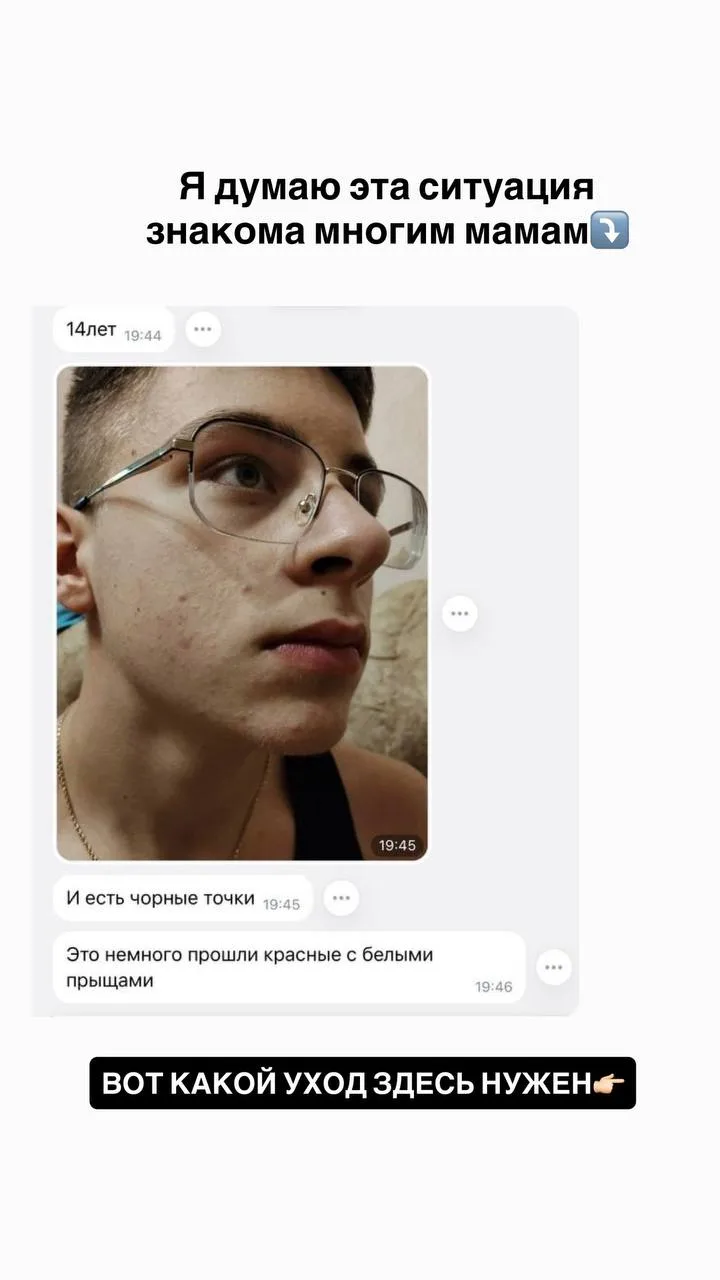 Высыпания, воспаления, черные точки, комедоны, чувствительная кожа — частая проблема по...