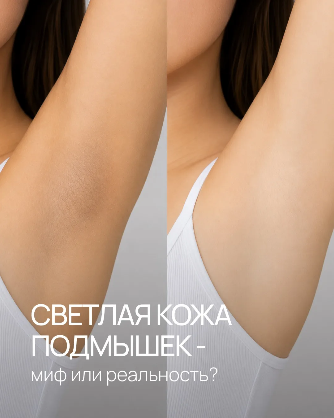 💥 ПОДМЫШКИ ПОСВЕТЛЕЮТ?
