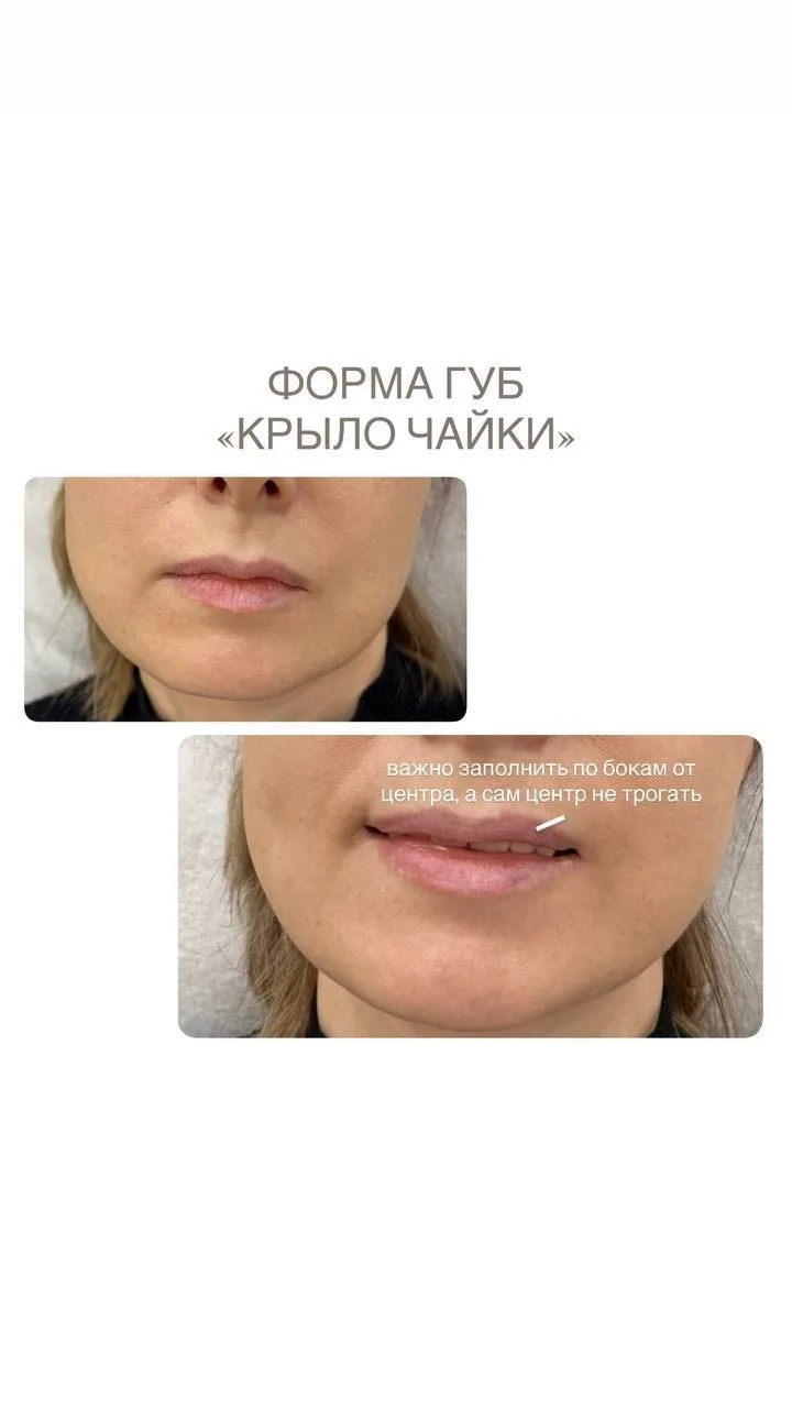 Коррекция сложных губ от Ольги Игоревны ❤️