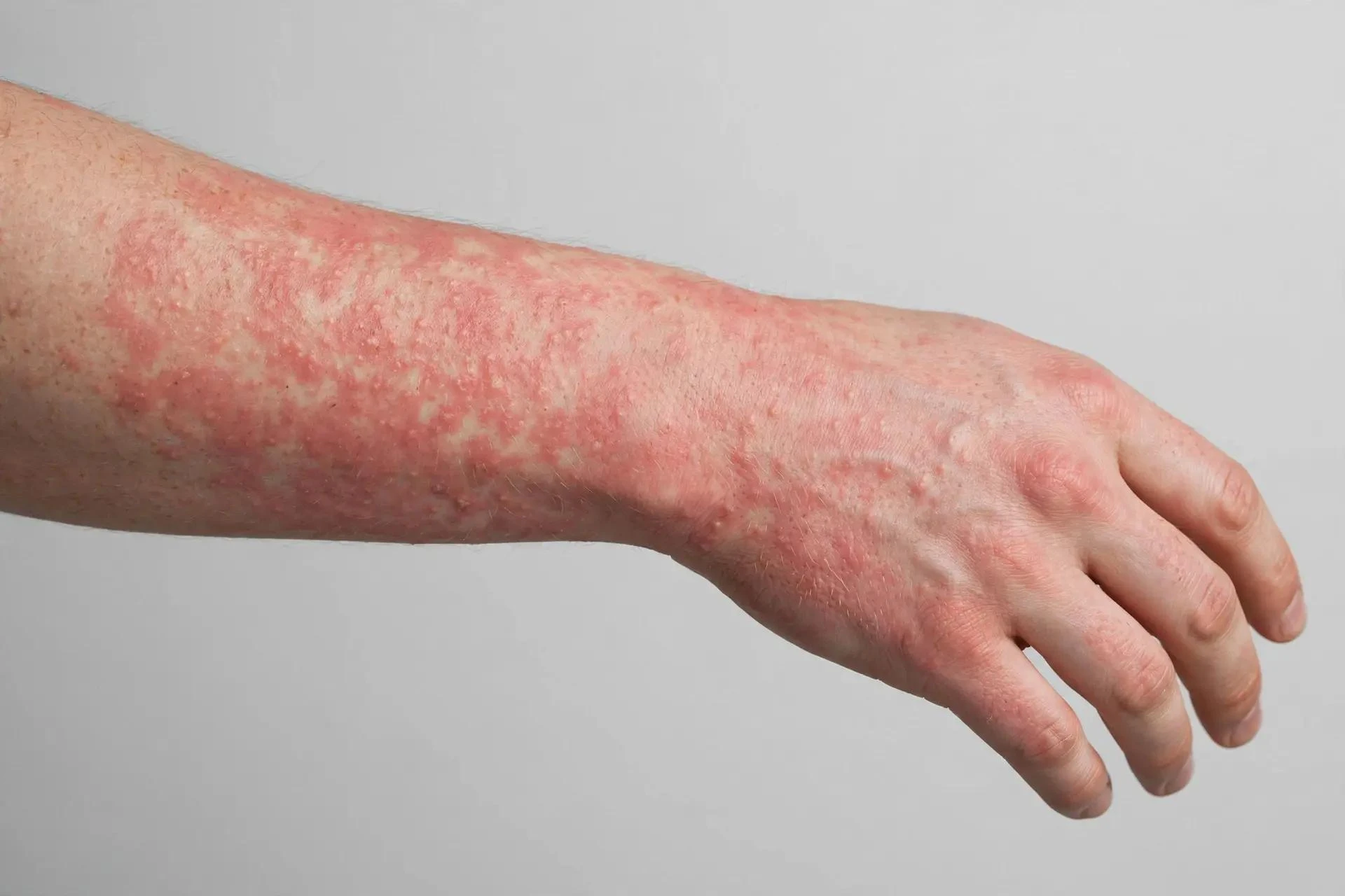 😷Отдых во Вьетнаме для тульской семьи обернулся больницей
