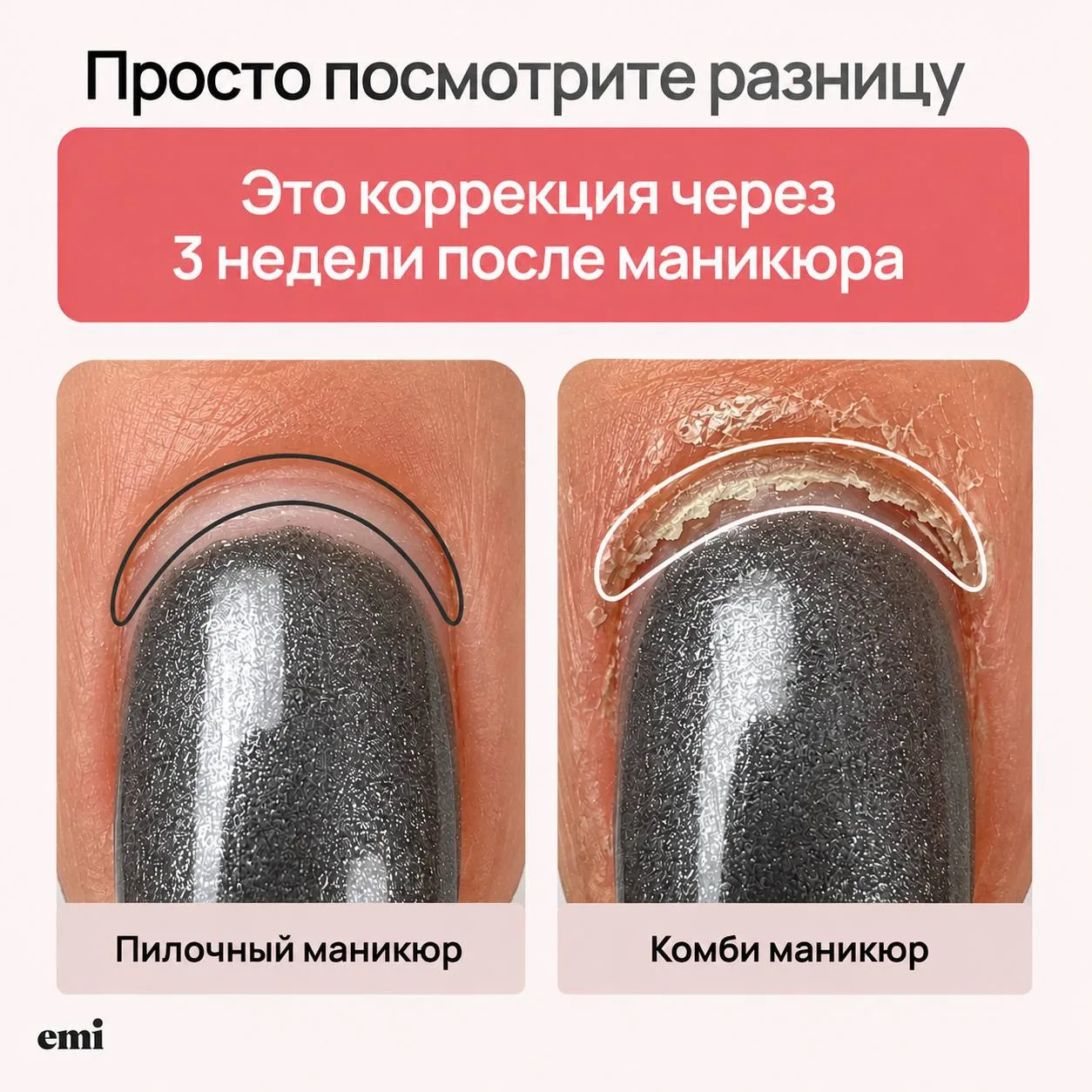 🎙 МЫ НАЧИНАЕМ SPA-ПРАКТИКУМ

Сегодня учимся делать пилочный маникюр с коллагеновым уходом + массаж 