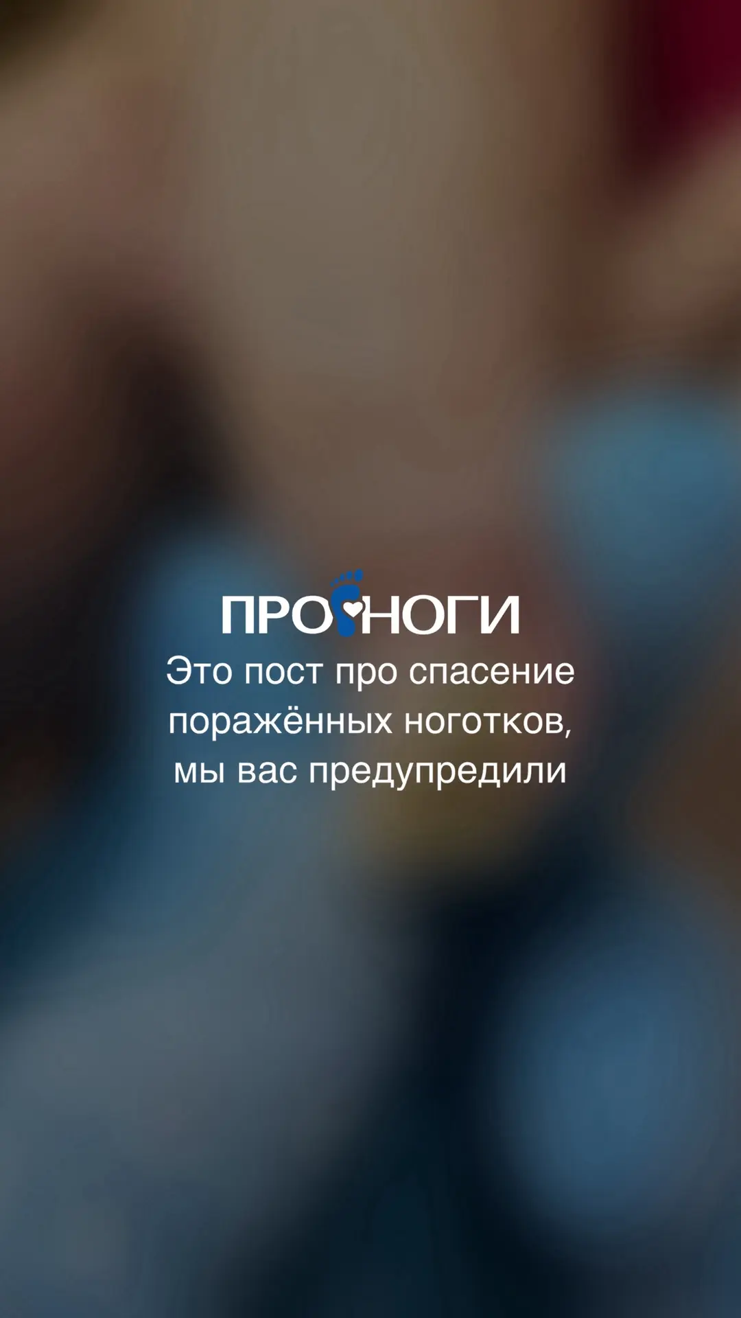 И такие случаи бывают у нас в центре педикюра и подологии «ПРО.ноги» 🫶🏻 выполнена зачистка ногтевы