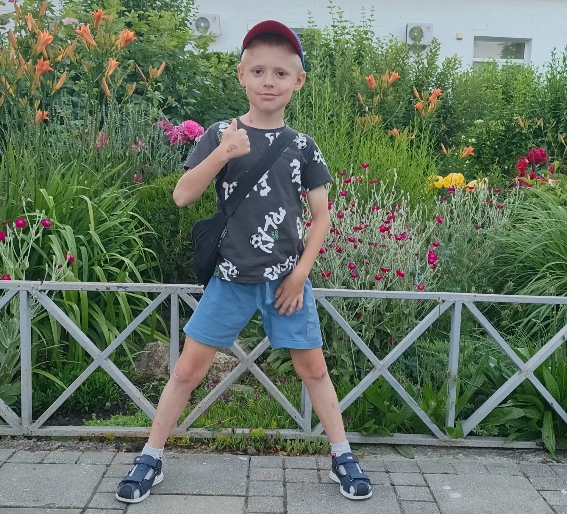 Спасибо за оказанную помощь для Артема!

Детей с редким генетическим заболеванием буллёзный эпидермо