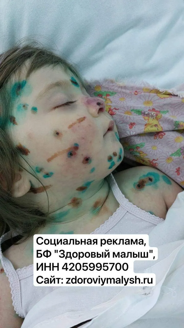 В два года Лиза словно потеряла всё, чему успела научиться.