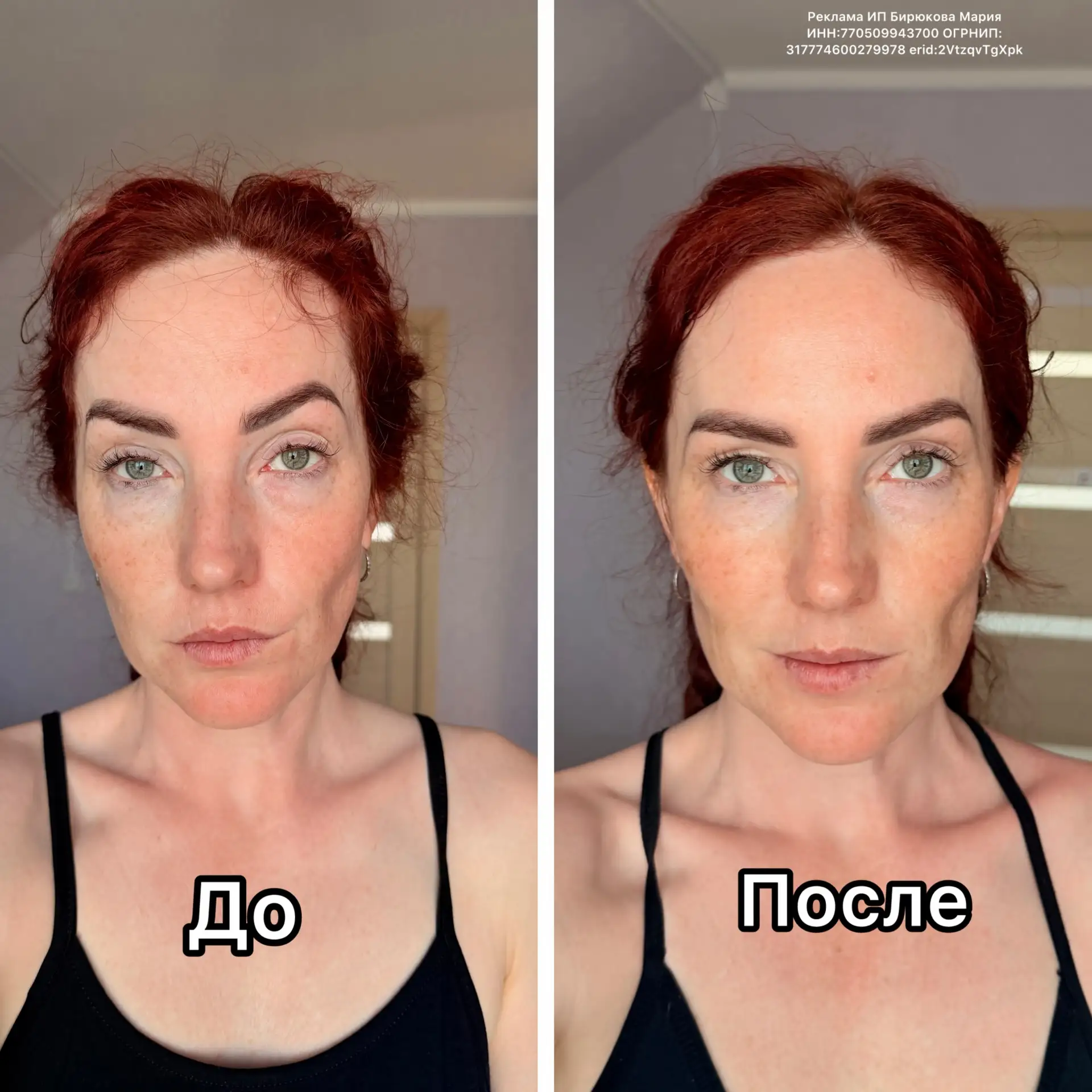 Это единственная вещь, которая помогает мне по утрам с отеками!   Флюид cryome дает 2 эффекта: - кра
