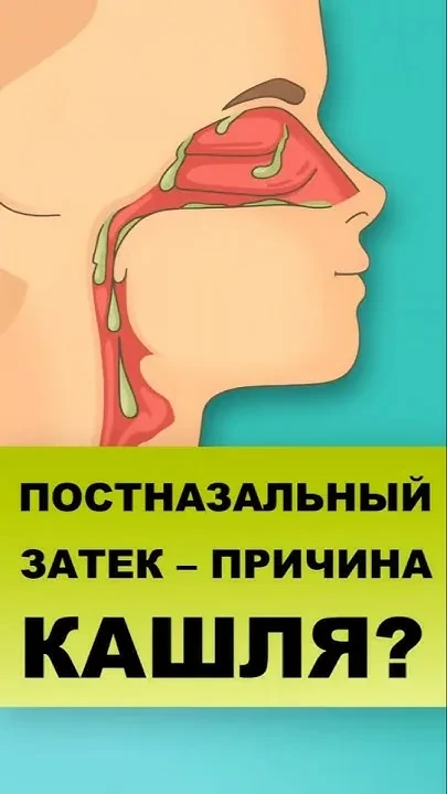 Постназальный затек- причина кашля?