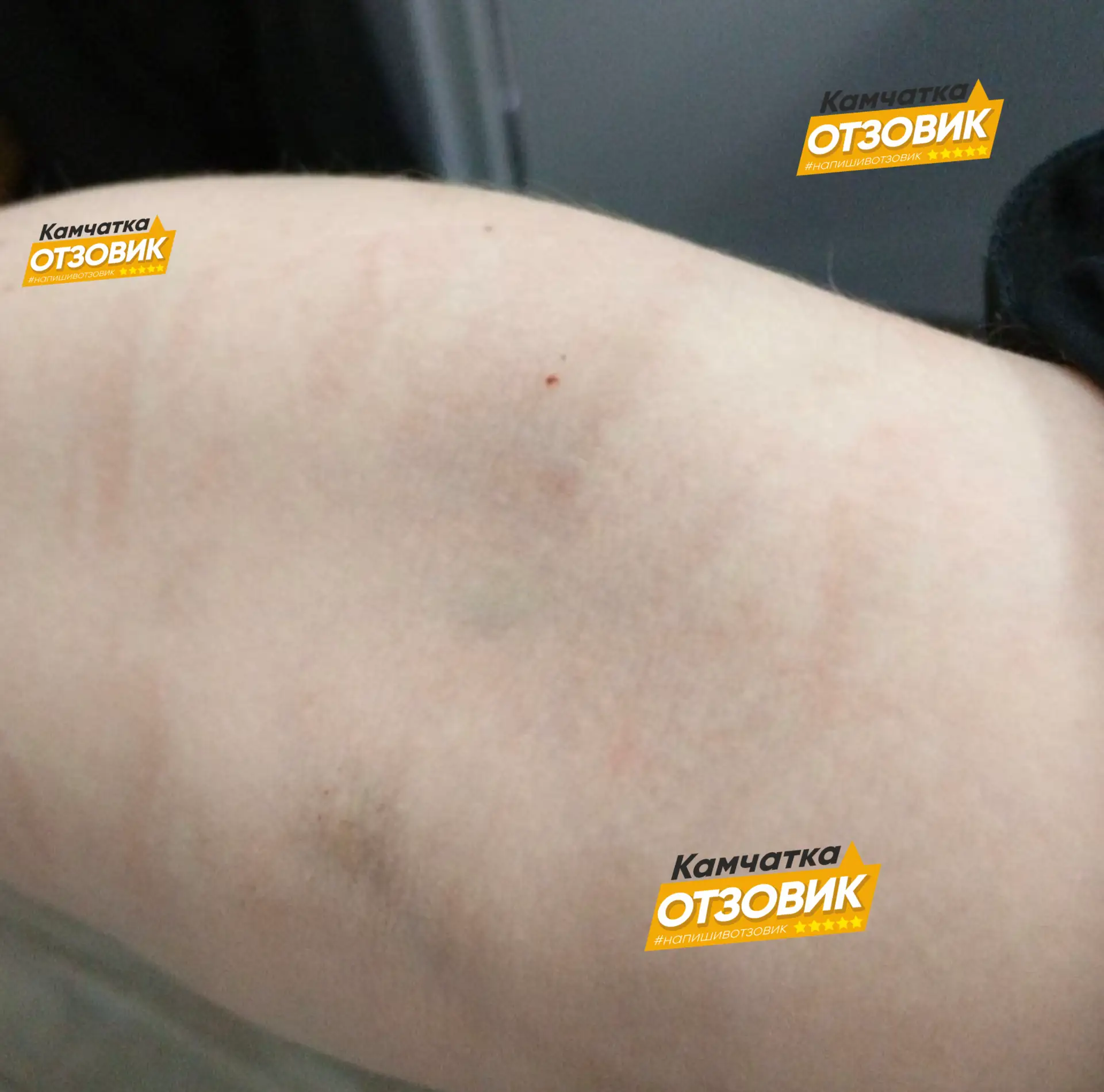 В медицинском центре «Медитекс» (Горького, 11/1): тщательно выбирайте процедурную медсе...