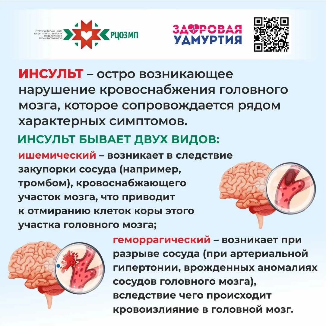 🧠 Инсульт — это острое нарушение мозгового кровообращения, возникающее из-за закупорки...