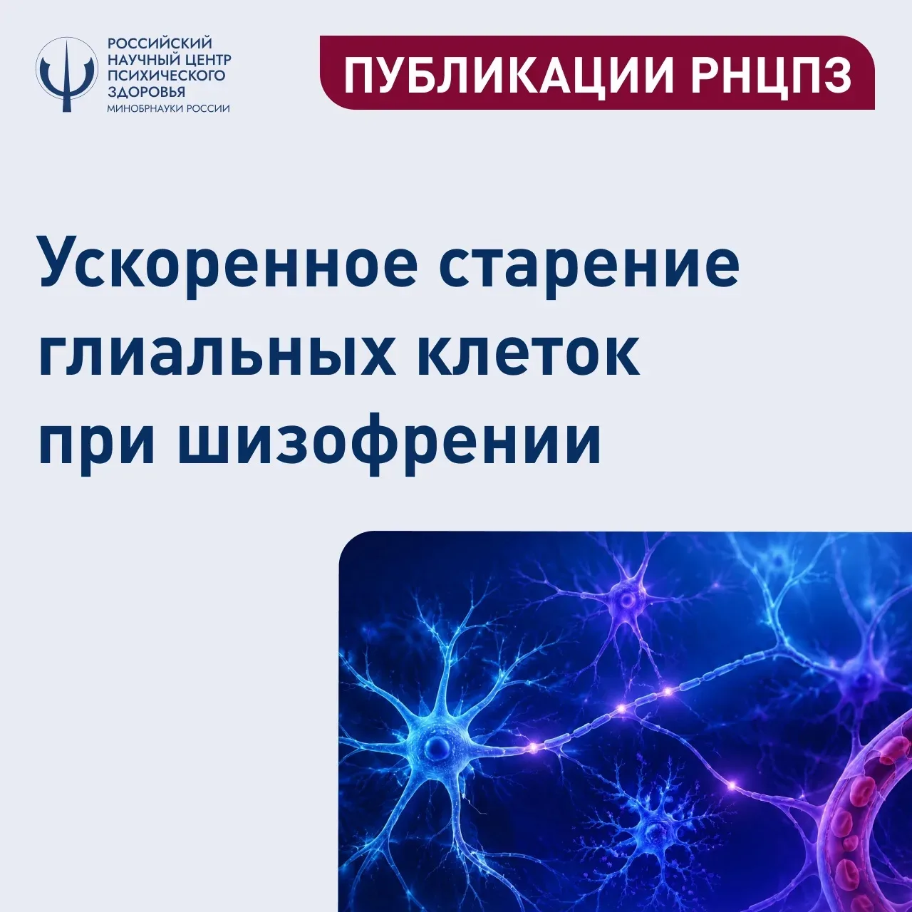 Ультраструктурные нарушения микроглии и олигодендроцитов при шизофрении 
 
⚡️Сотрудники РНЦПЗ опубли